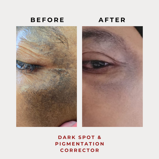 Nanoskin Dark Spot & Pigmentation Serum 30g