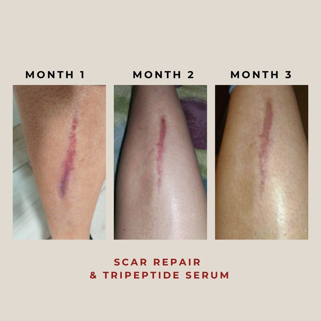 Nanoskin Scar Repair & Tri-Peptide Serum 30g